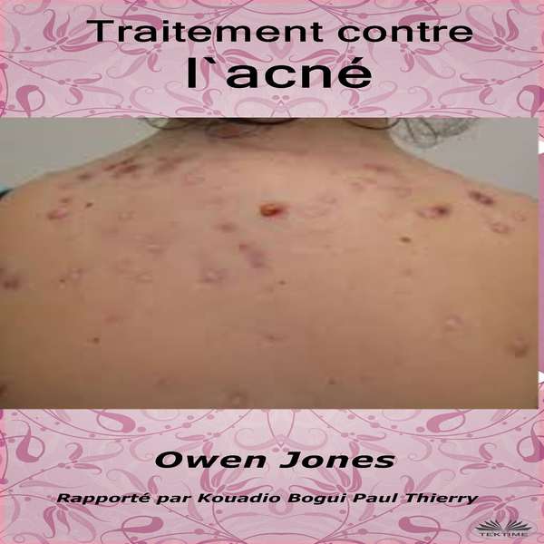 Traitement Contre L'Acné written by Owen Jones and narrated by Kouadio Bogui Paul Thierry 