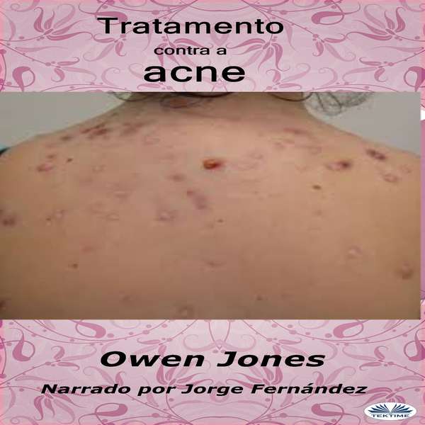 Tratamiento Del Acné written by Owen Jones and narrated by Jorge Fernández 