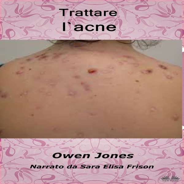 Trattare L'Acne written by Owen Jones and narrated by Sara Elisa Frison 